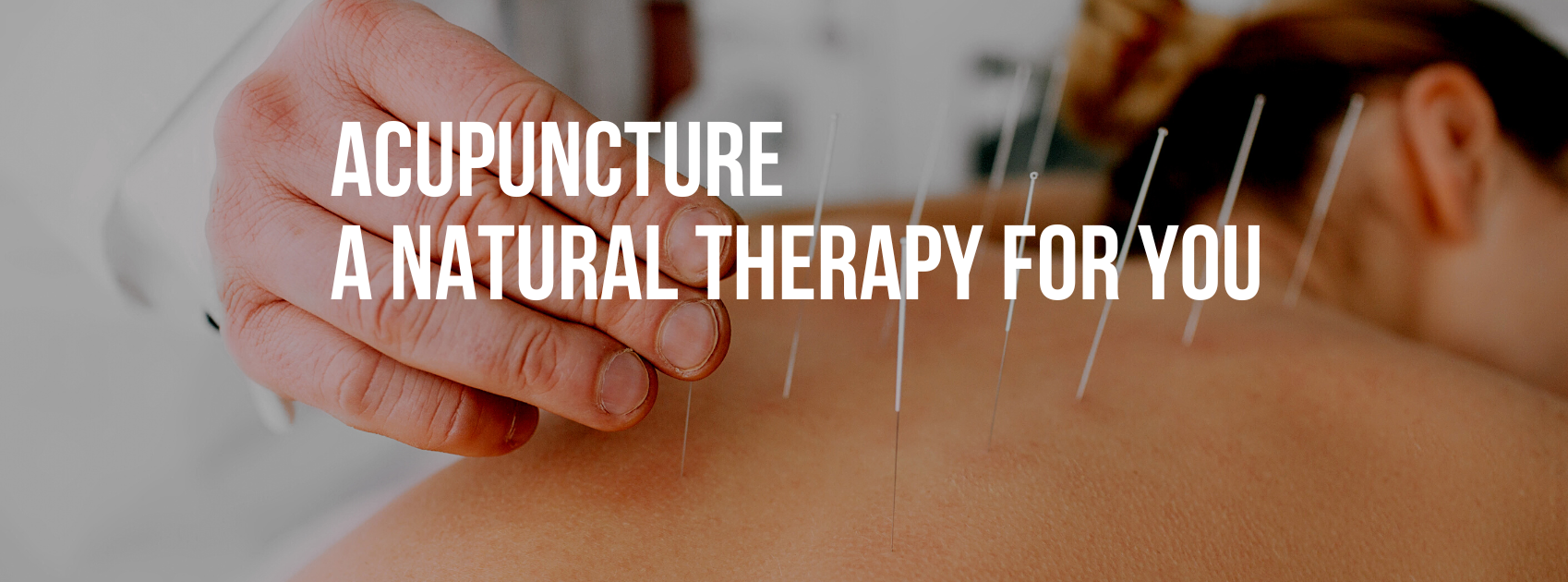 Acupuncture - A Natural Therapy For You!