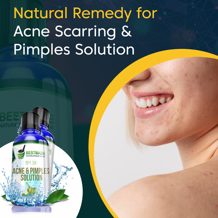 Acne Scarring & Pimples Natural Solution (BM38) - BM 
