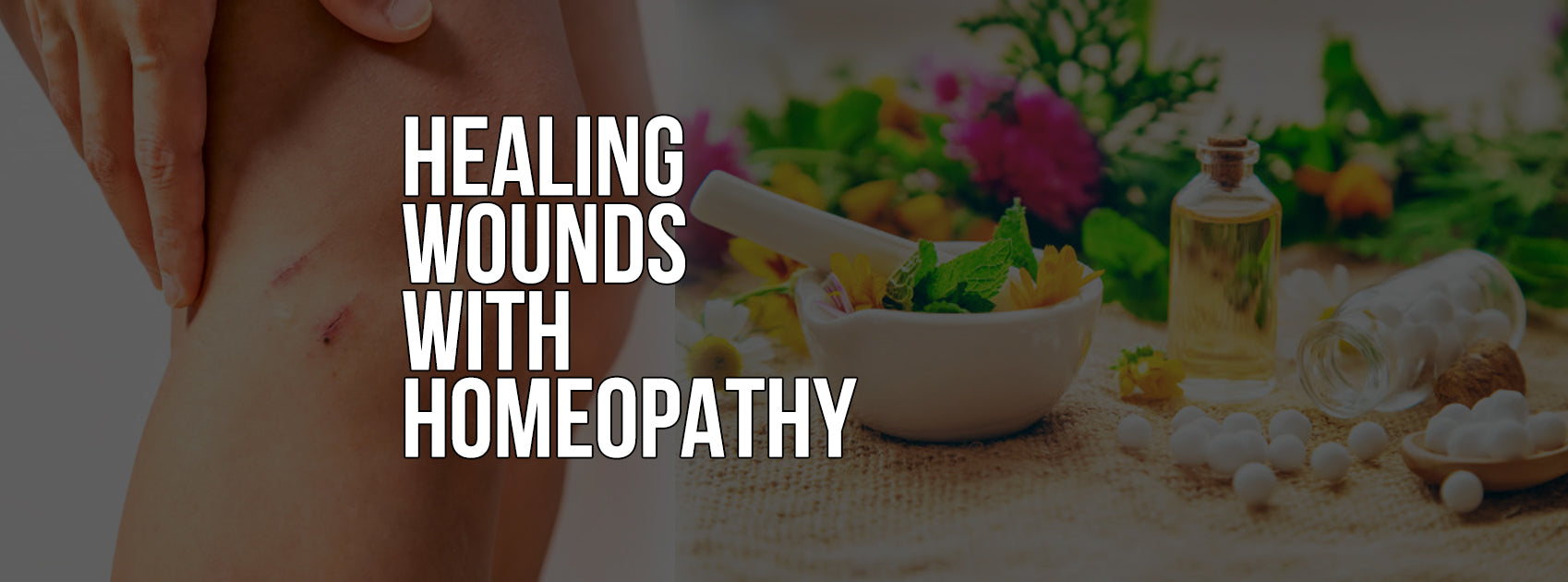 HEALING WOUNDS NATURALLY WITH HOMEOPATHY