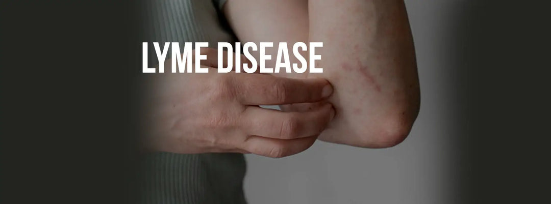 LYME DISEASE - CAUSES & HOW TO EASE SYMPTOMS