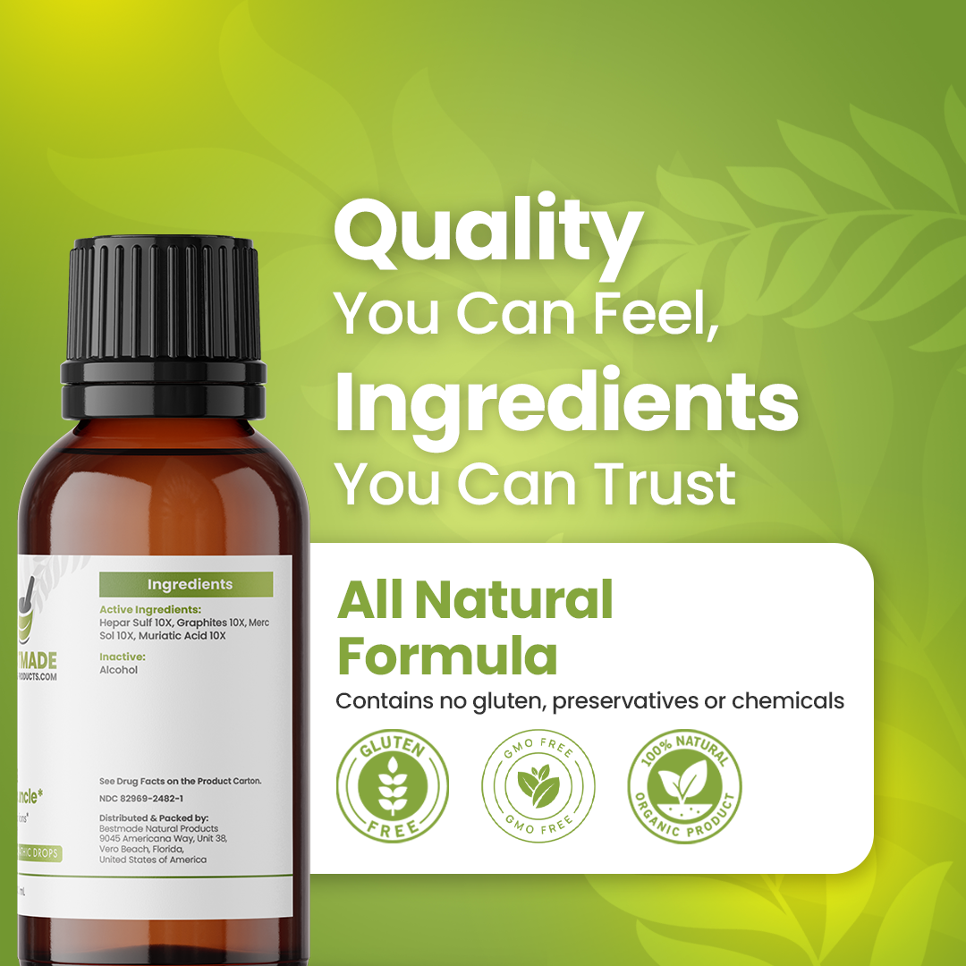 Tratamento De Boil &amp; Carúnculo BM182, 30mL, Tratamento Natural de Força máxima, Drops Antibacterianos que ajudam a combater Staphylococcus Aureus &amp; Remover Boils