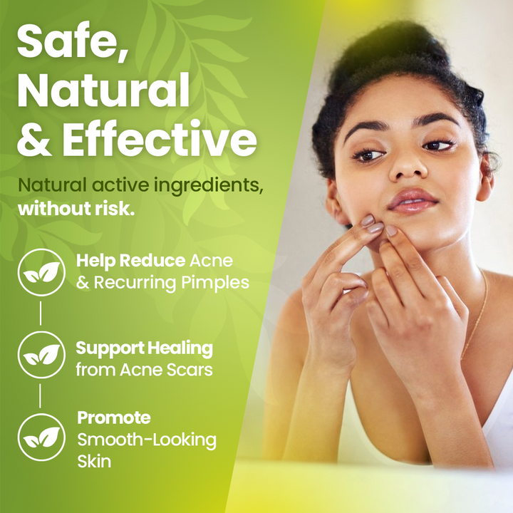 Acne Scarring &amp; Pimples Solution (BM38) - Acne, Recurring Pimples, Scars| Homeopathic Combination Remedy, Non-Toxic, Natural, 30 mL Drops