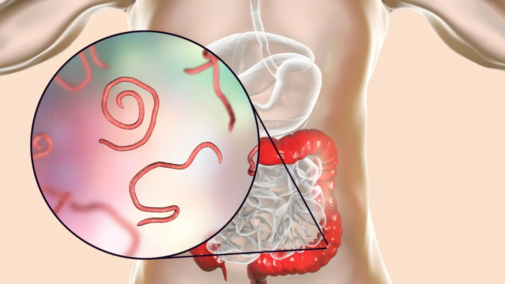 Computer illustration of threadworm infection