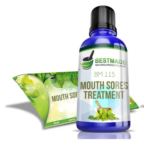 Mouth sores treatment natural remedy