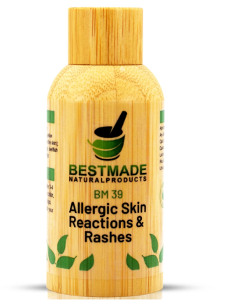 Natural allergic skin reactions and rashes