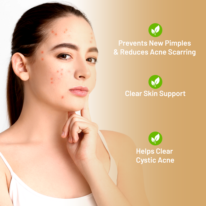 Acne Scarring & Pimples Natural Solution (BM38) - BM