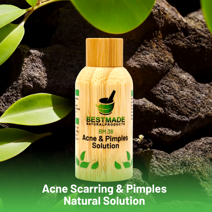 Acne Scarring & Pimples Natural Solution (BM38) - BM