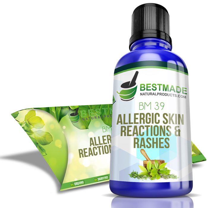 Allergic Reactions & Skin Rashes BM39 (30mL) - Simple