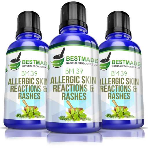 Allergic Reactions & Skin Rashes BM39 (30mL) Triple Pack-