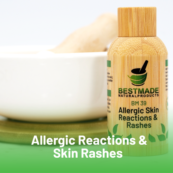 Allergic Reactions & Skin Rashes BM39 (30mL) Triple Pack-