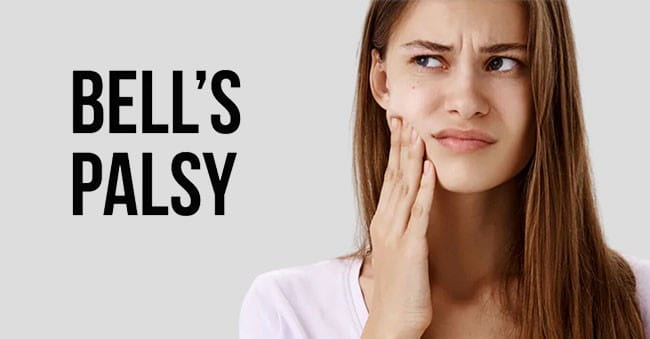 Natural Remedy for Facial Paralysis (Bell’s Palsy) BM68