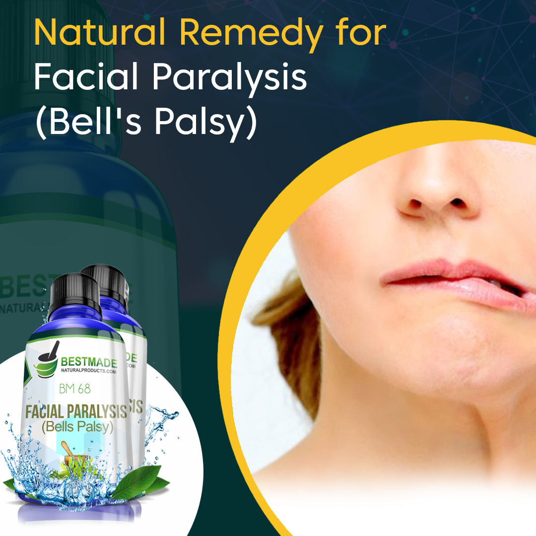 Natural Remedy for Facial Paralysis (Bell’s Palsy) BM68