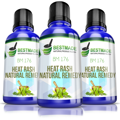 Natural Remedy for Heat Rash (BM176) 30ml Triple Pack- Save