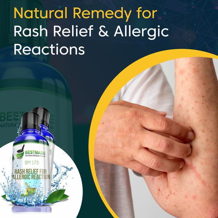 Rash Relief & Allergic Reactions Remedy BM173 - Simple 