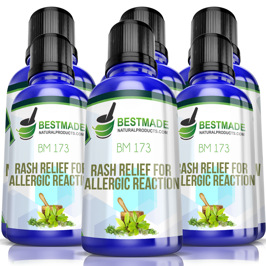 Rash Support & Allergic Reactions Remedy BM173 Six Pack-