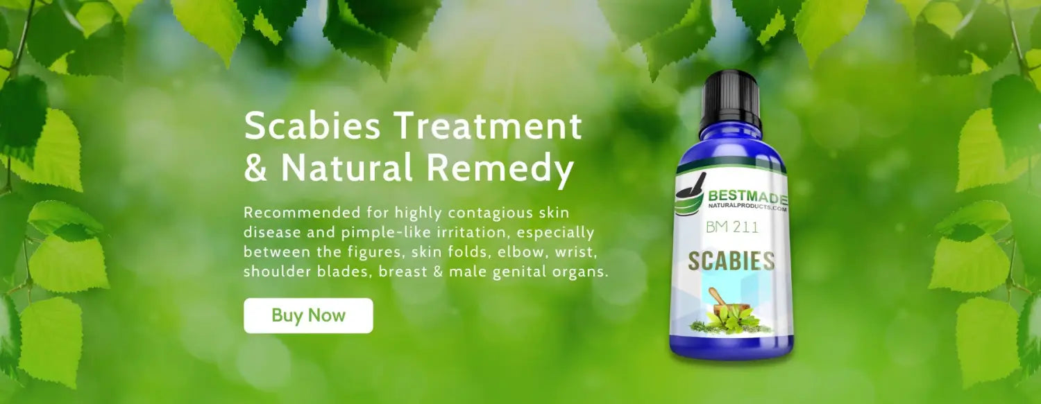 Scabies Treatment & Natural Remedy (BM211)