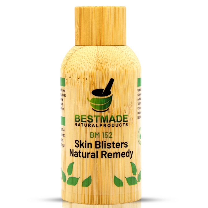 Skin Blisters Natural Remedy (BM152) 30ml - BM Products