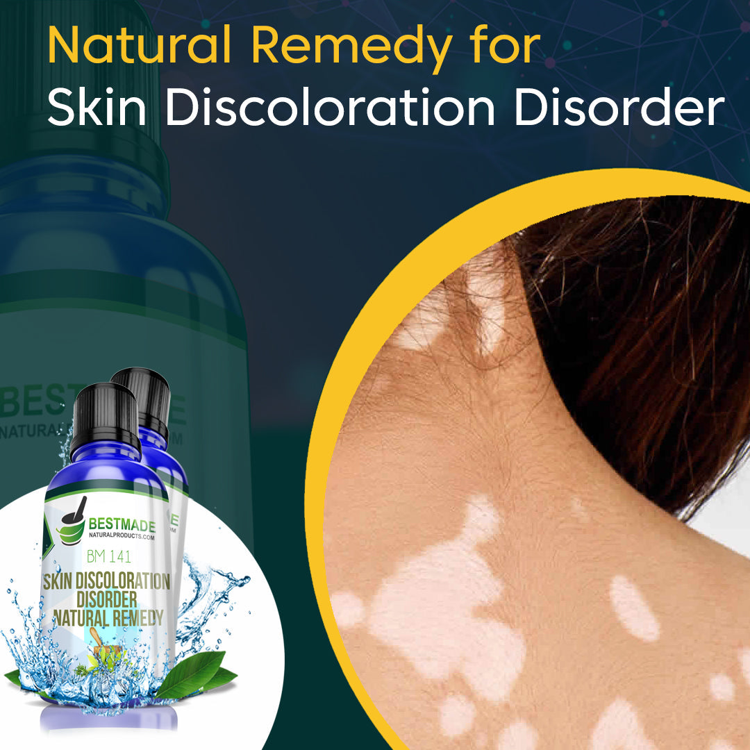 Skin Discoloration Disorder Natural Remedy (BM141) Triple