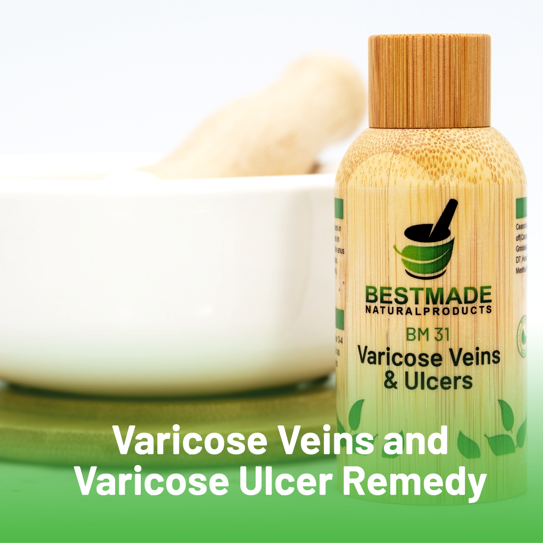 Varicose Veins and Varicose Ulcer Remedy (BM31) - Simple