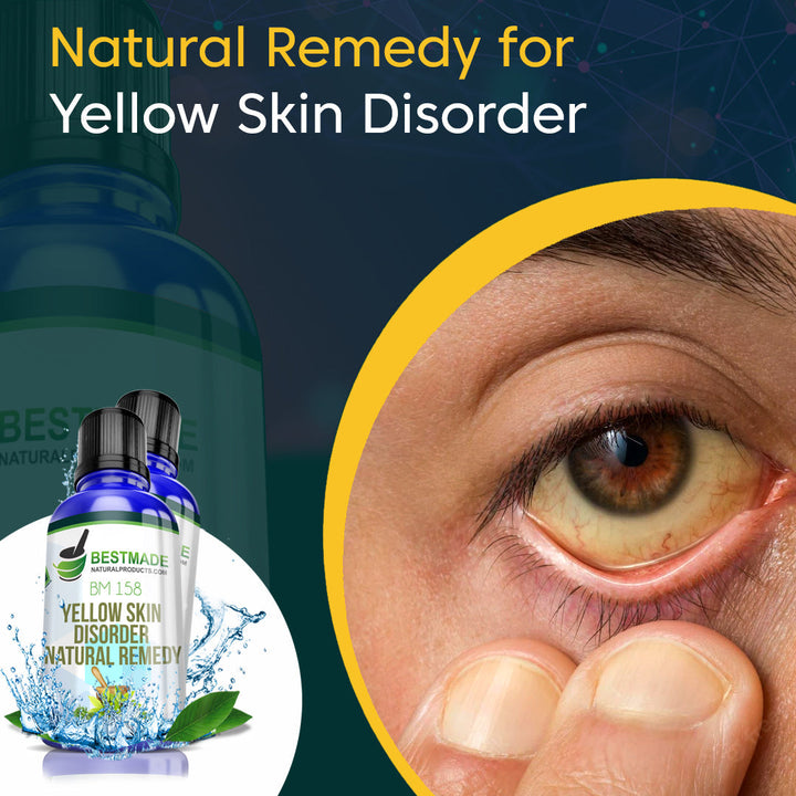 Yellow Skin Disorder Natural Remedy (BM158) - BM Products