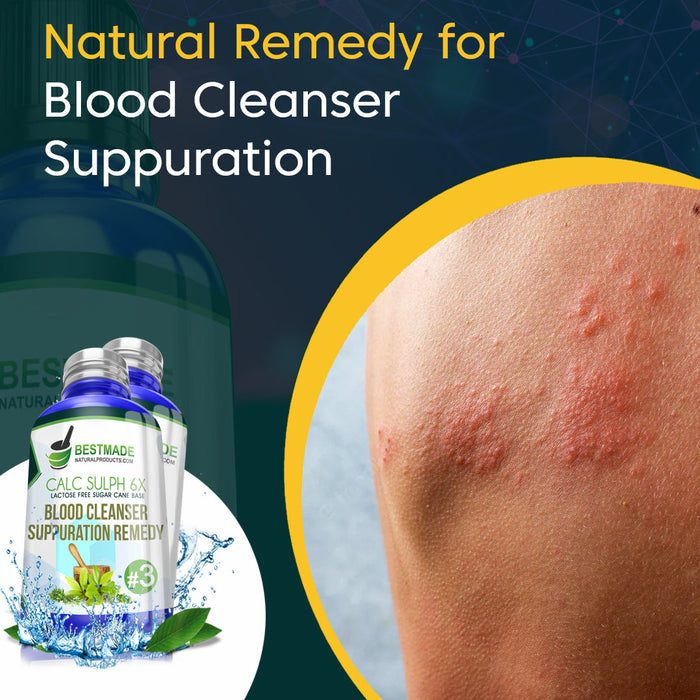 Lactose Free Acne Suppuration Remedy Tablets - Simple 