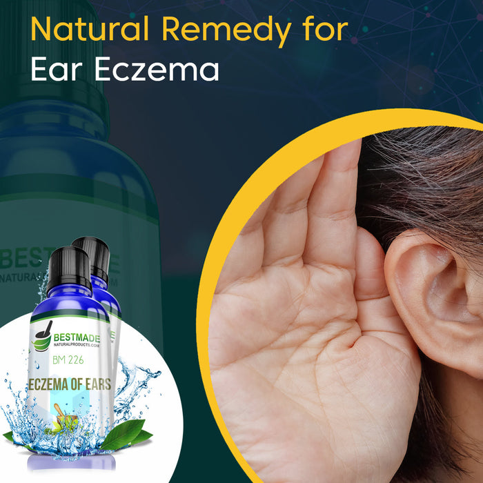 Atopic Eczema behind the Ear: Discover Effective Remedies