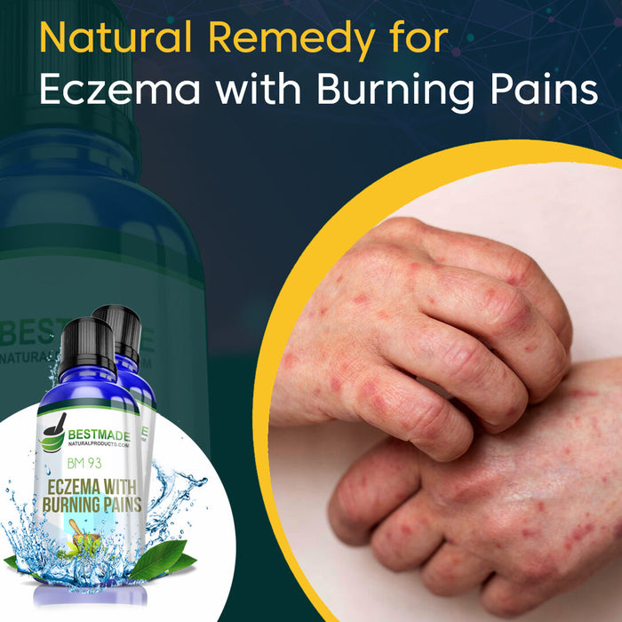 Natural Remedy for Eczema with Burning Pains (BM93) - BM 