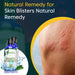 Skin Blisters Natural Remedy (BM152) 30ml - BM Products