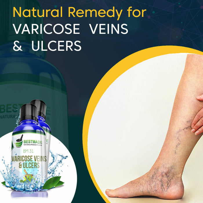 Varicose Veins and Varicose Ulcer Remedy (BM31) - Simple 